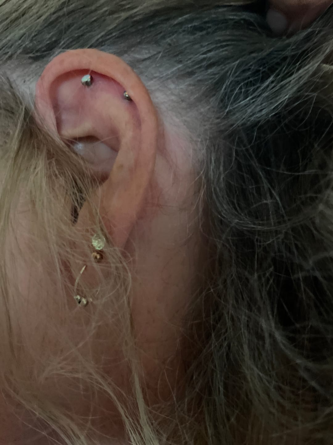 Customer photo review of Junipurr Titanium Flatback Labret Threadless