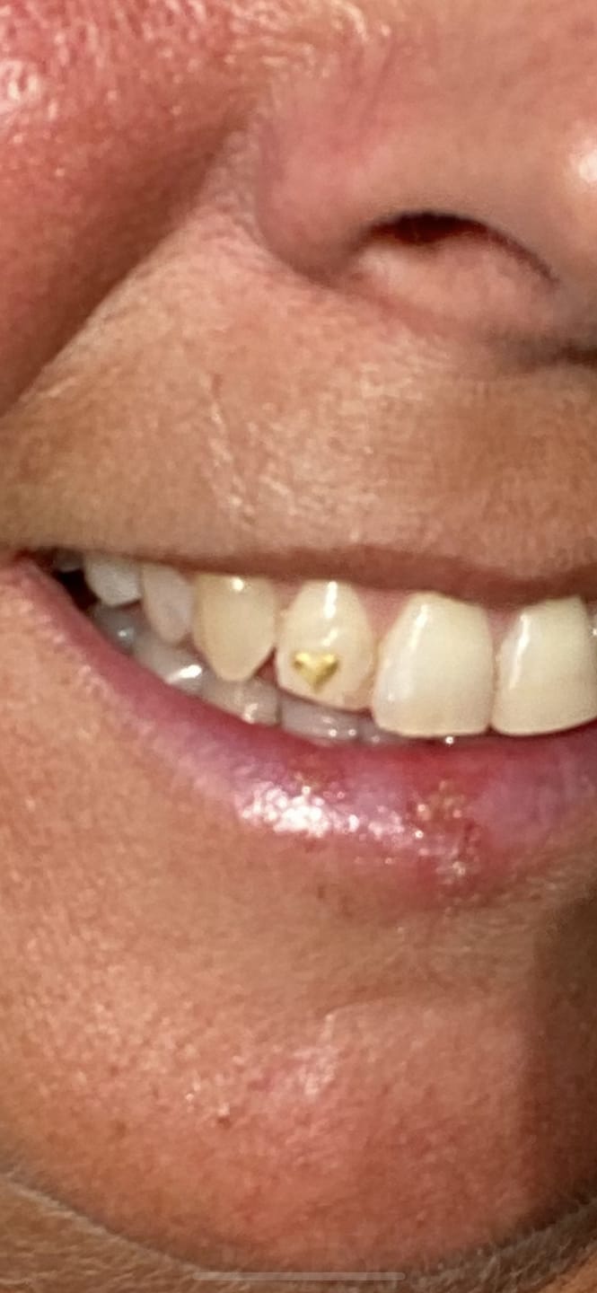 Customer photo review of Large Heart 24-karat gold