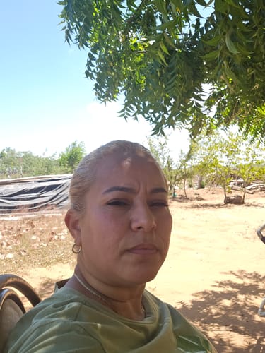 Customer photo review of Bioxtron | Collagen Peptides