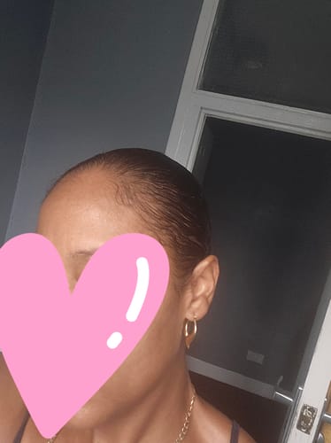 Customer photo review of 100% Pure Batana Oil