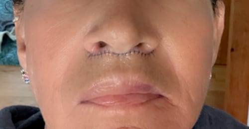 Customer photo review of Scar Gel