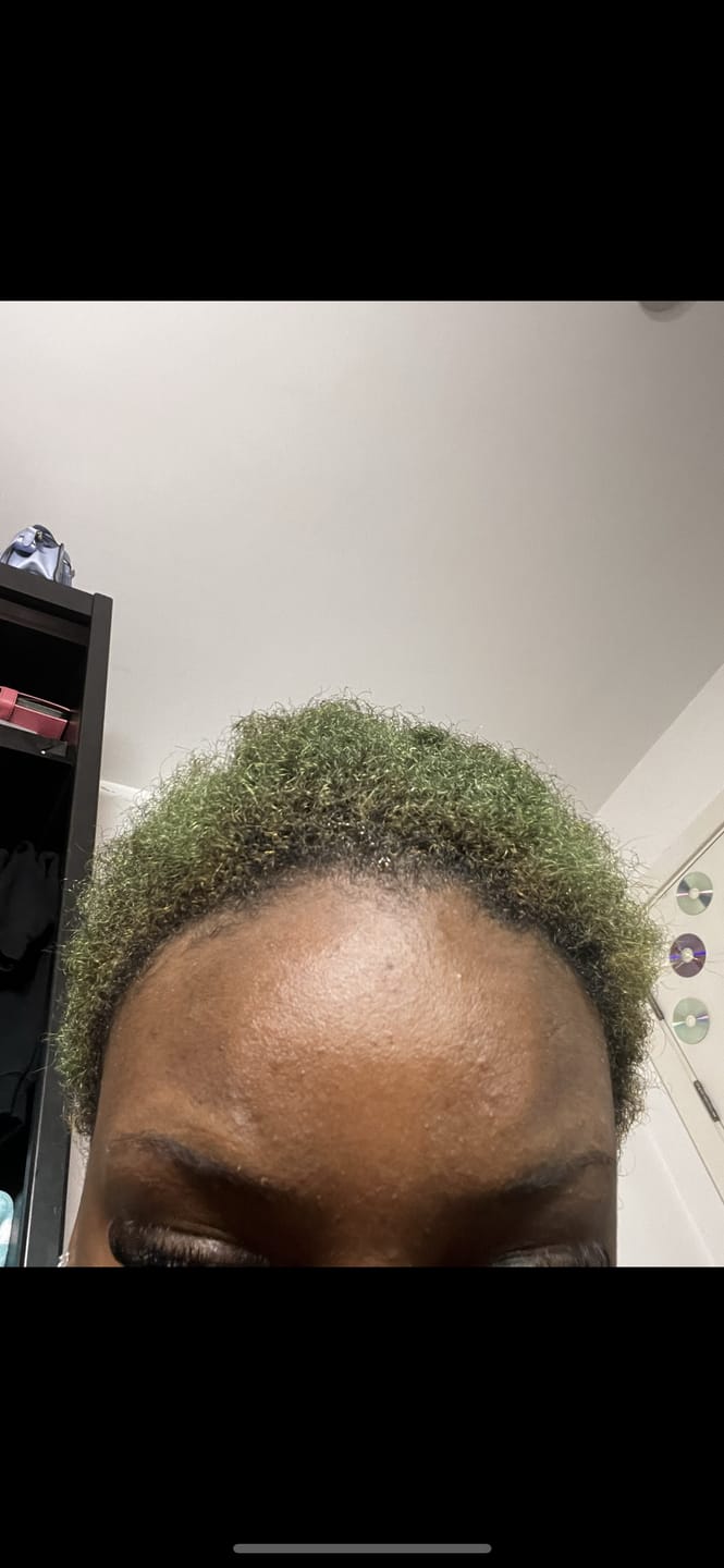Customer photo review of 100% Natural Hair Growth / Thickening Oil
