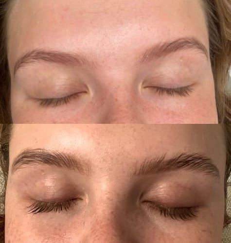 Customer photo review of 2x iGlow Lash Maximizer – Lash Serum, 3 ml