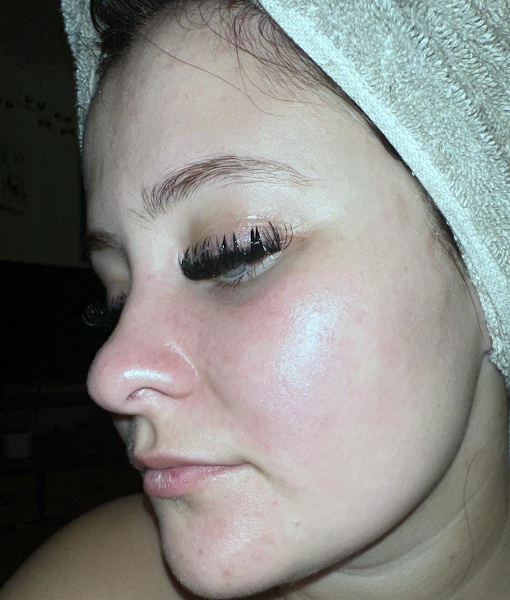 Customer photo review of Nature's Bliss - Tallow & Honey Balm - 2 oz