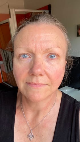 Customer photo review of Tagescreme mit Hyaluron | Day Cream