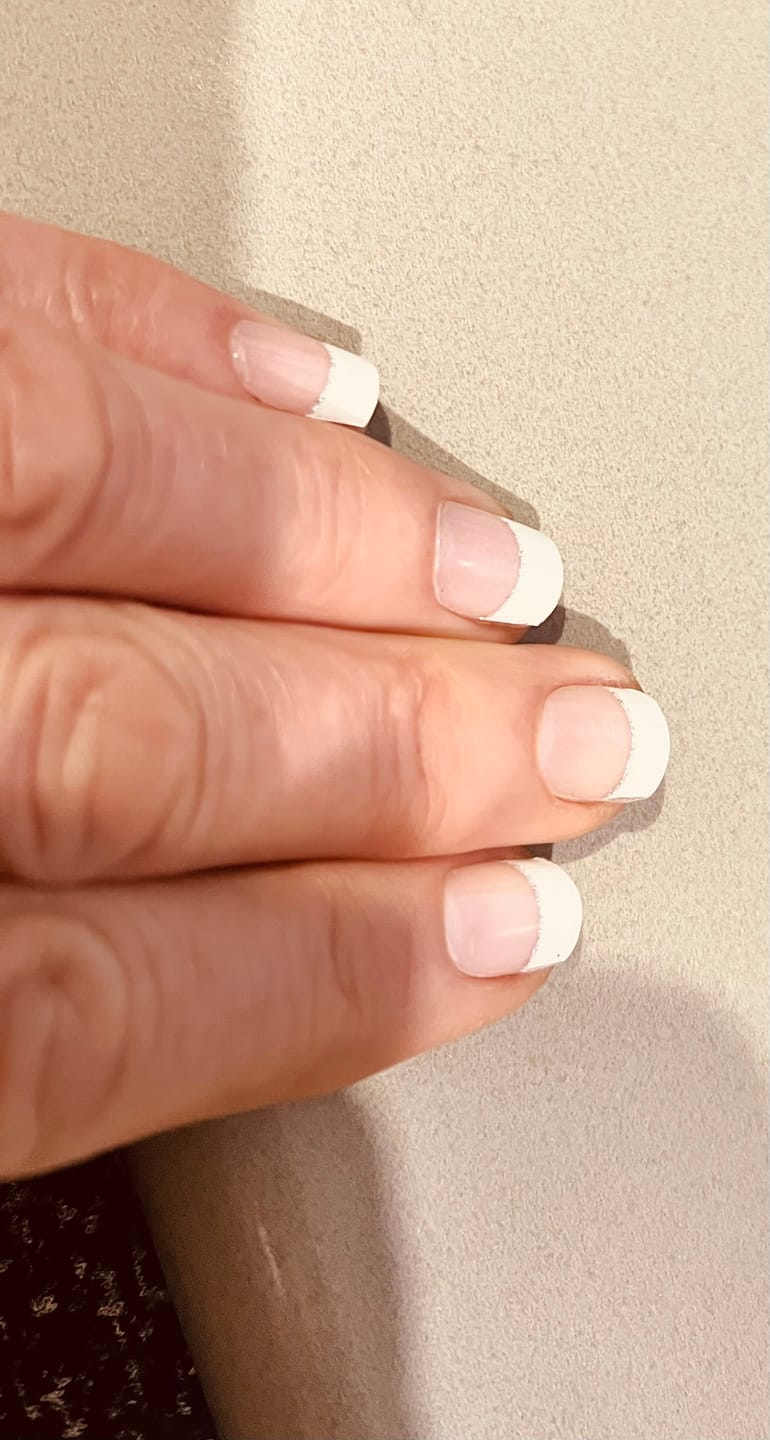 Customer photo review of White French Tip Glitter DIY Semicured Gel Nail Sticker Kit