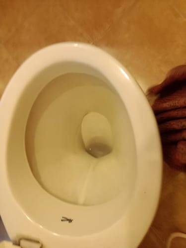 Customer photo review of Heavy Duty Toilet Bowl Cleaner & Tough Limescale\Descaler  | Combo