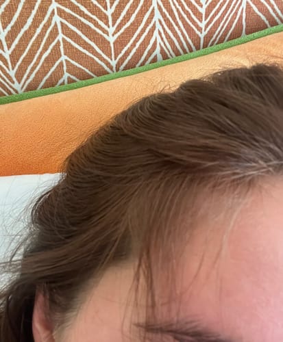 Customer photo review of Pre-Wash Scalp Oil by TR