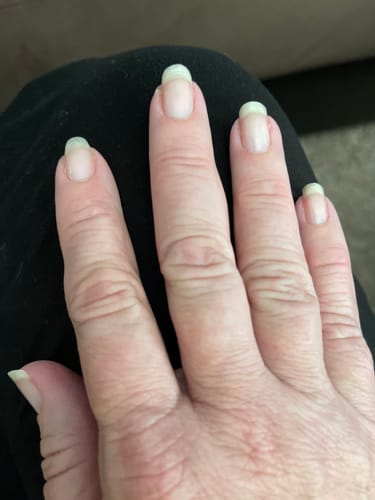 Customer photo review of Rocket Nail Fuel Nail Repair - Purple