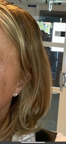 Customer photo review of Sunkissed Starter Kit