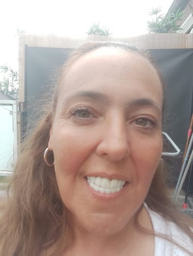 Customer photo review of Teeth-Veneer 2.0