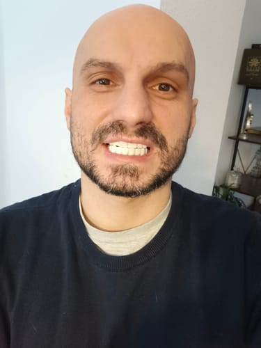 Customer photo review of Teeth-Veneer 2.0