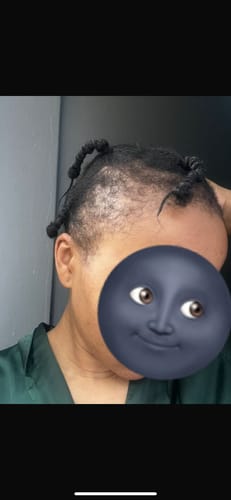 Customer photo review of Scalp Serum Set