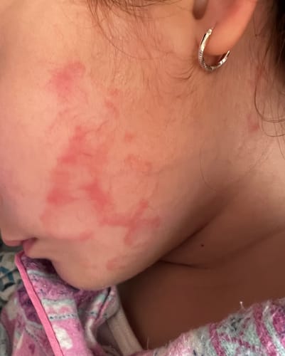 Customer photo review of Emulsión Recuperadora