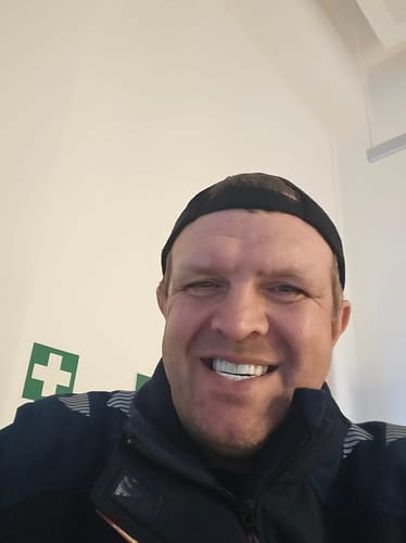 Customer photo review of Teeth-Veneer 2.0