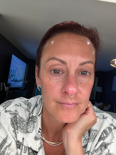 Customer photo review of Faux Freckles Makeup Patches