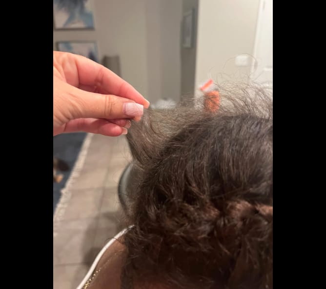 Customer photo review of Rosemary Scalp Treatment