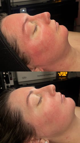 Customer photo review of The CryoPeptide 100 Pack