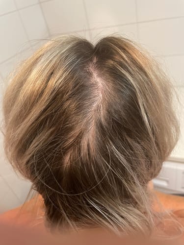 Customer photo review of Sunkissed Starter Kit