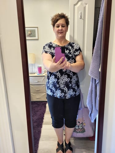 Customer photo review of CHLOE™ WOMEN'S STYLISH ORTHOPEDIC SANDALS 2024