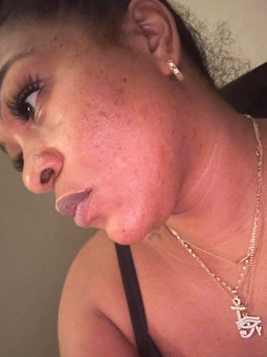Customer photo review of LIMITED EDITION KIT Jolie’s Mini Full Body & Face Brightening Kit