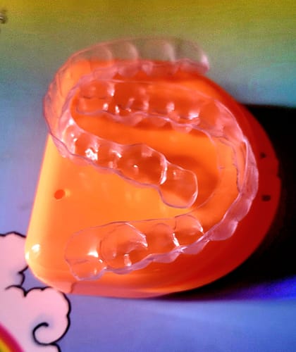 Customer photo review of File Your Smile (A Digital Copy of Your Impressions For Future Replacement Products)