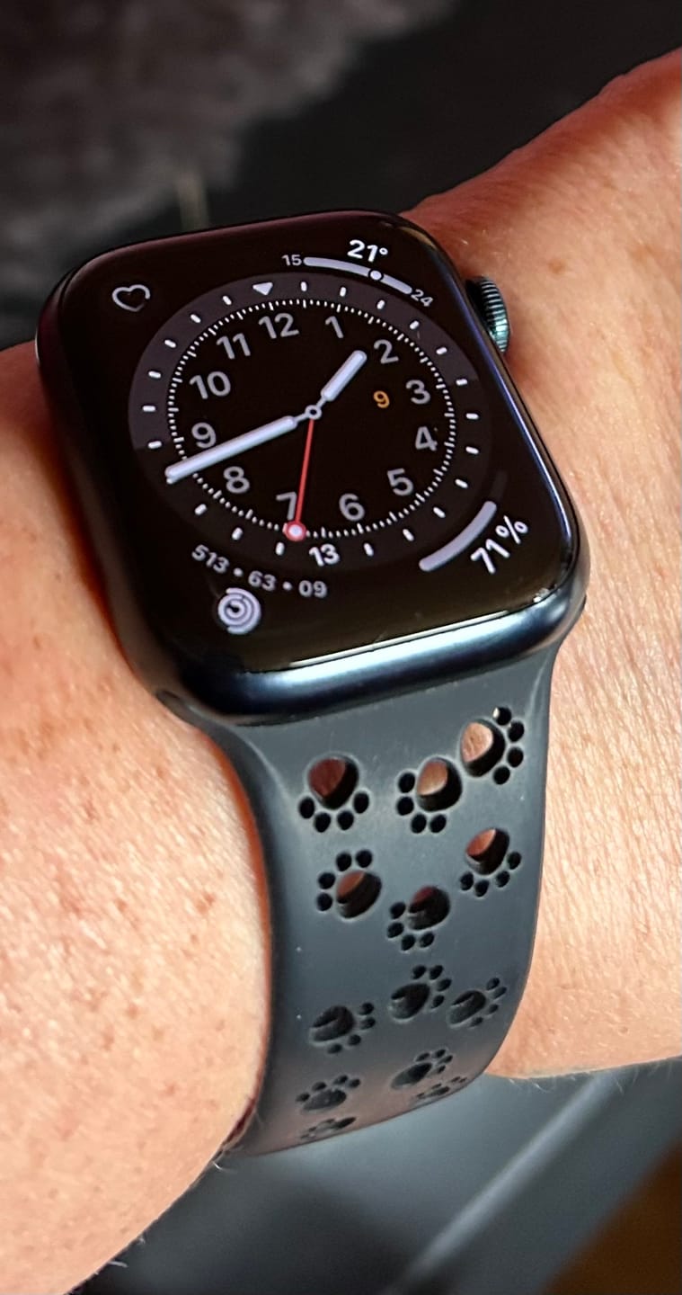 Customer photo review of Apple Watch Silikonband "Pfoten"