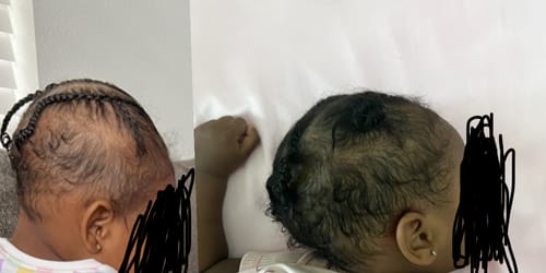Customer photo review of Nourishing Growth Oil 8 oz.