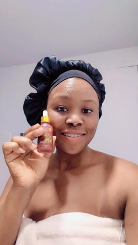 Customer photo review of Acne Treatment Serum