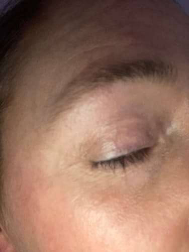 Customer photo review of iGlow Lash Maximizer - Lash Serum, 3 ml