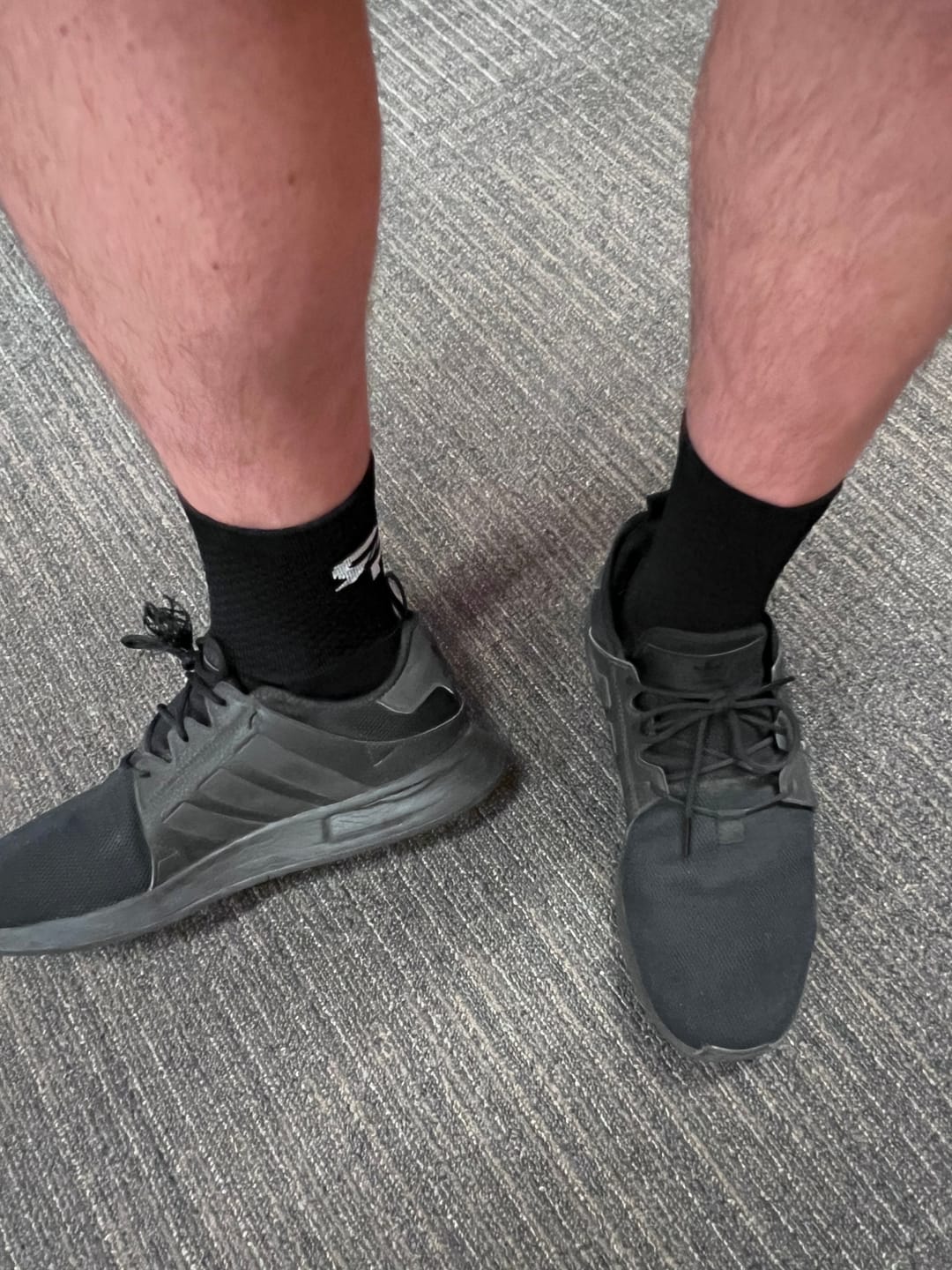 Customer photo review of RTP ULTRAGRIP V2 Dual sided Non-slip Technology Socks