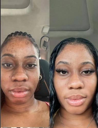 Customer photo review of Discoloration Brightening Corrector