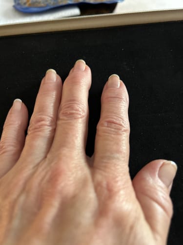 Customer photo review of Nail Care Pro -  Nail Strengthener and Repair Serum