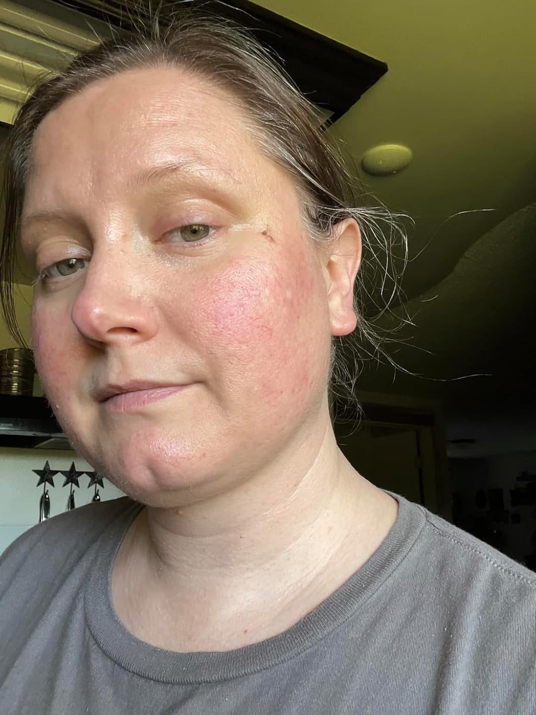 Customer photo review of Whipped Tallow Moisturizer