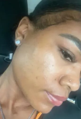 Customer photo review of Discoloration Brightening Corrector