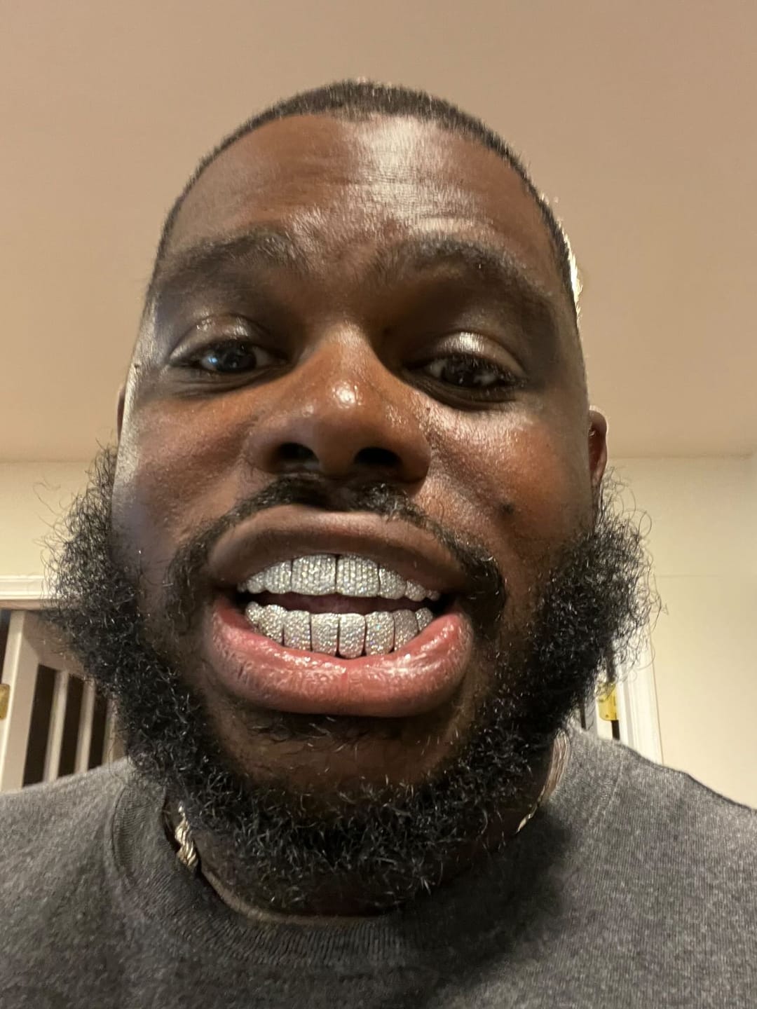 Customer photo review of Custom Perm Cut Honeycomb Setting Grillz