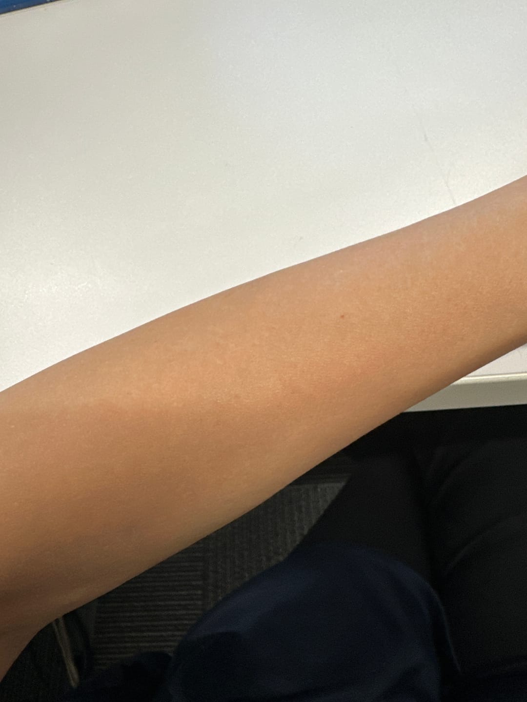 Customer photo review of Ulike Air10 家用脫毛儀