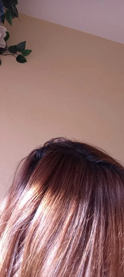 Customer photo review of Fulica™ - Anti Hair Loss Shampoo