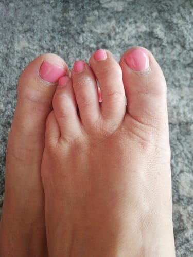 Customer photo review of Glowdip All-in-One Manicure Set