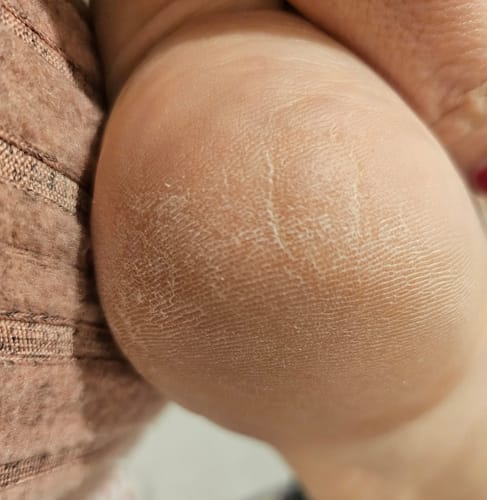 Customer photo review of Seyskyn Crystal Clear Glass Foot File