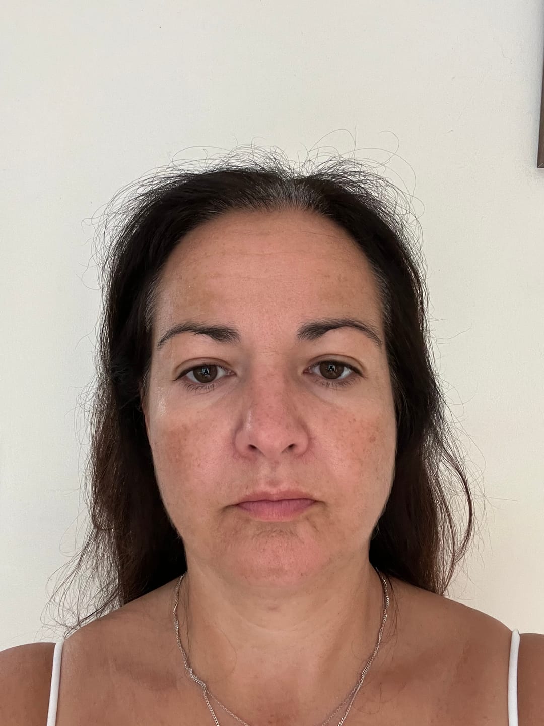 Customer photo review of Anti-Fatigue Eye Mask