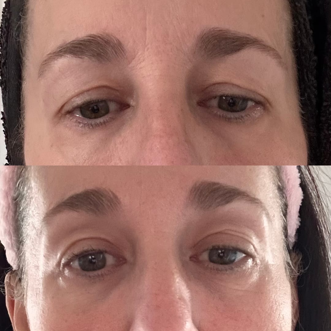Customer photo review of Anti-Fatigue Eye Mask