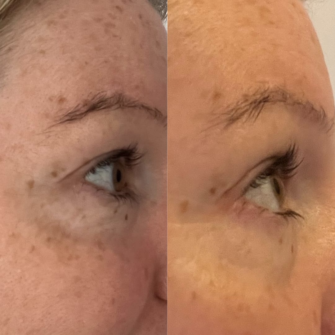 Customer photo review of Anti-Fatigue Eye Mask