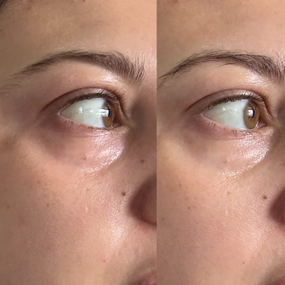 Customer photo review of Anti-Fatigue Eye Mask