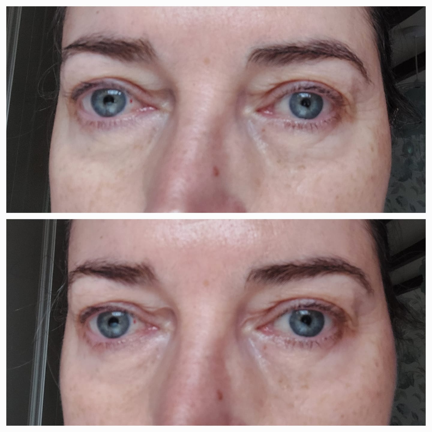 Customer photo review of Anti-Fatigue Eye Mask