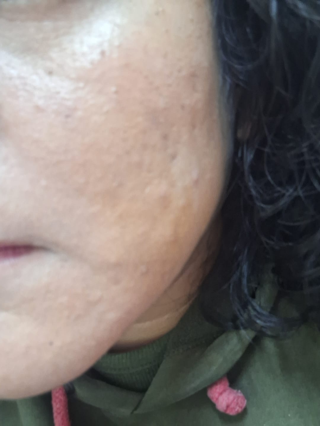 Customer photo review of SKIN1004 - Madagascar Centella Travel Kit | Kit Hidratante y Calmante
