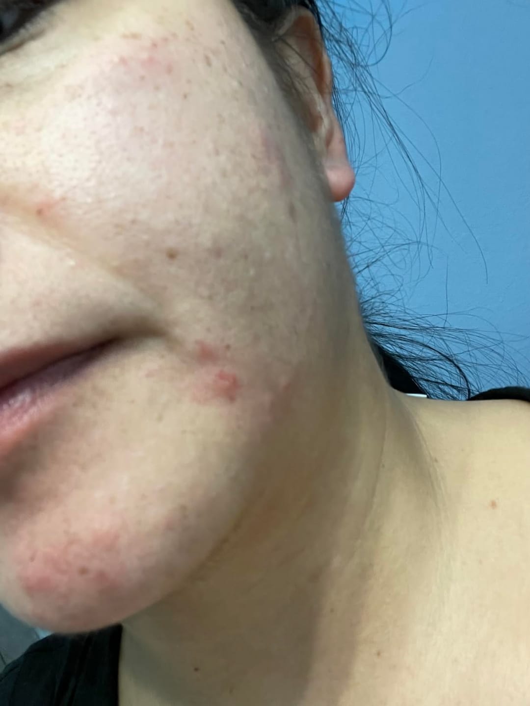 Customer photo review of Whipped Tallow Moisturizer