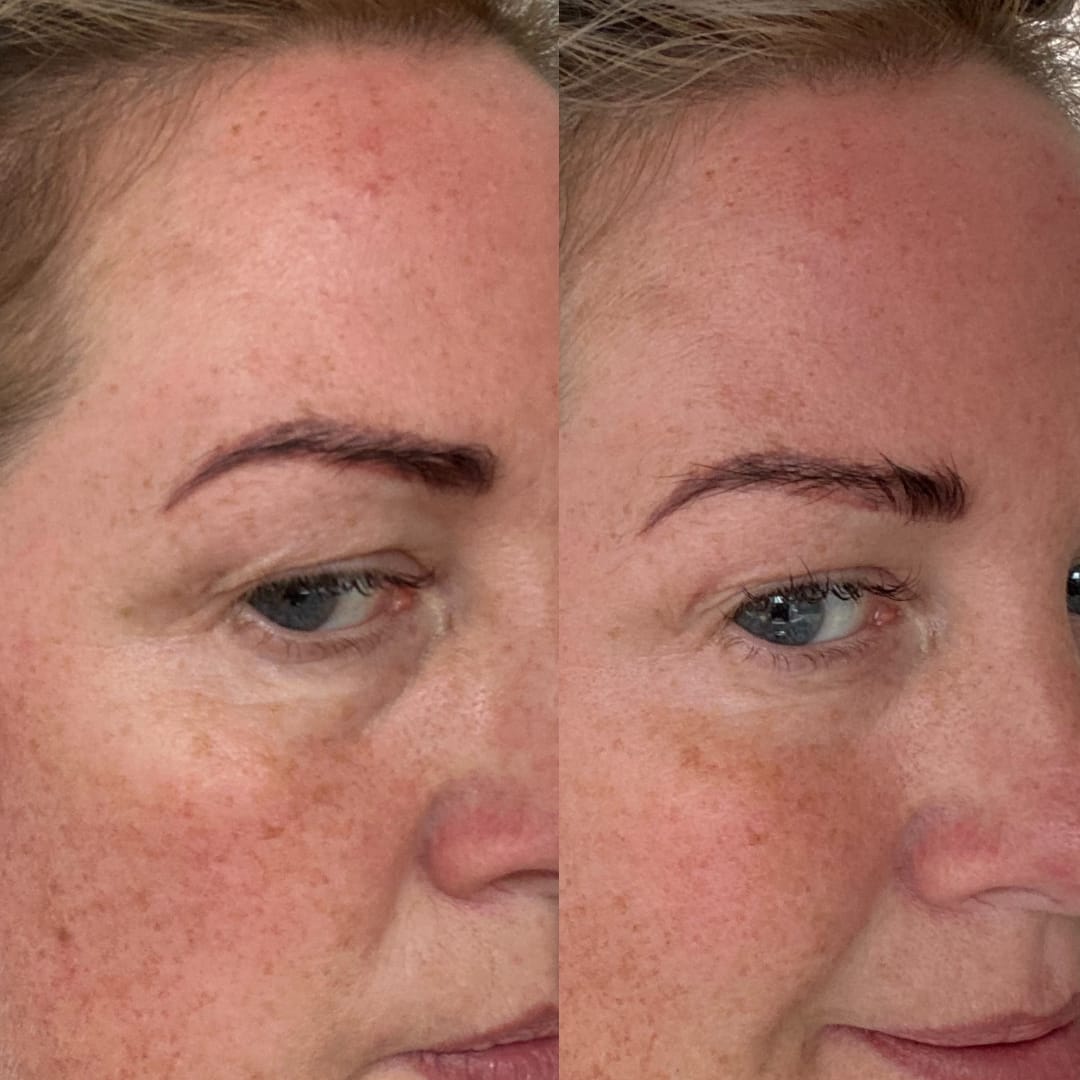 Customer photo review of Anti-Fatigue Eye Mask