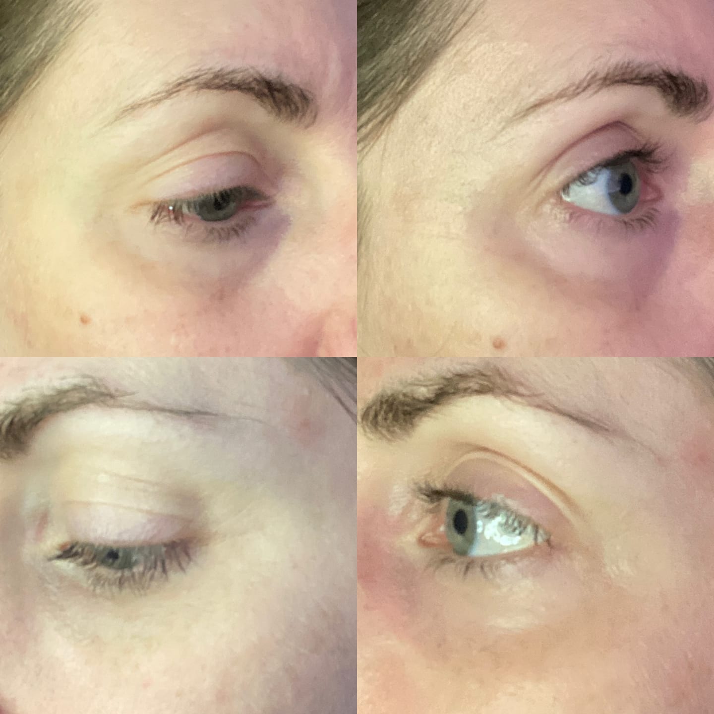 Customer photo review of Anti-Fatigue Eye Mask