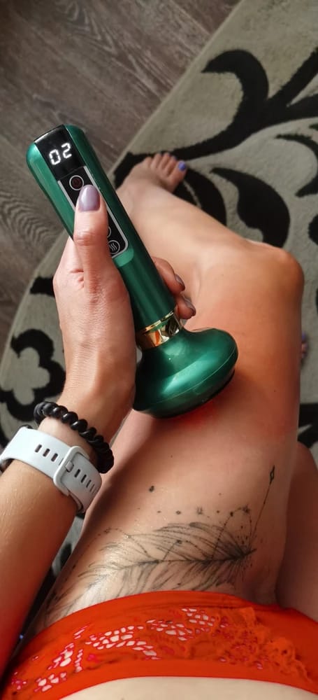Customer photo review of Revimus Anti-Cellulite Massager